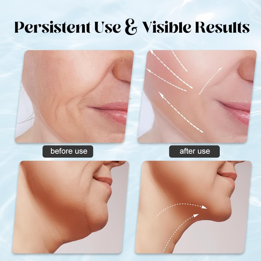 EMS Face Lifting Skin Massager | Facial Neck & Eye Skin Best Therapy