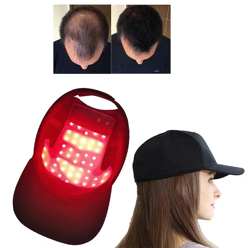 Red Light Therapy For Hair Growth: Cordless Heating Cap For Men & Women