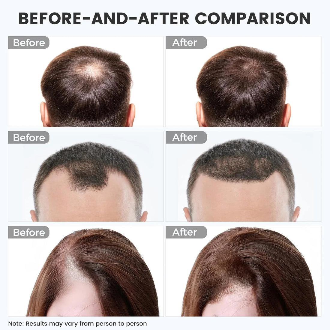 Red Light Therapy For Hair Growth: Cordless Heating Cap For Men & Women